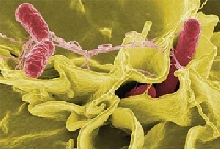 Vi khuẩn "ăn ruột" cực kỳ nguy hiểm