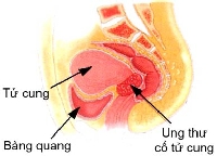 10 nguyên nhân gây cường kinh