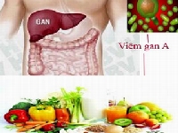 Ai dễ mắc bệnh viêm gan A?