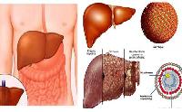 Viêm gan tối cấp: căn bệnh đặc biệt nguy hiểm