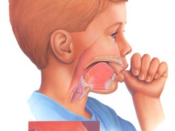 Khi nào cần đưa trẻ đi nắn chỉnh răng?